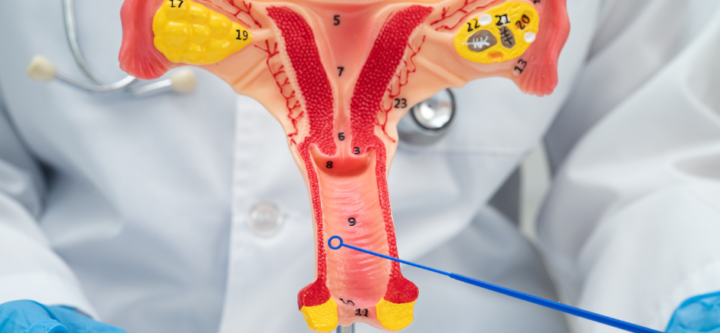 Untitled design (2) IVF TREATMENT FOR OBSTRUCTIVE AND NON-OBSTRUCTIVE AZOOSPERMIA