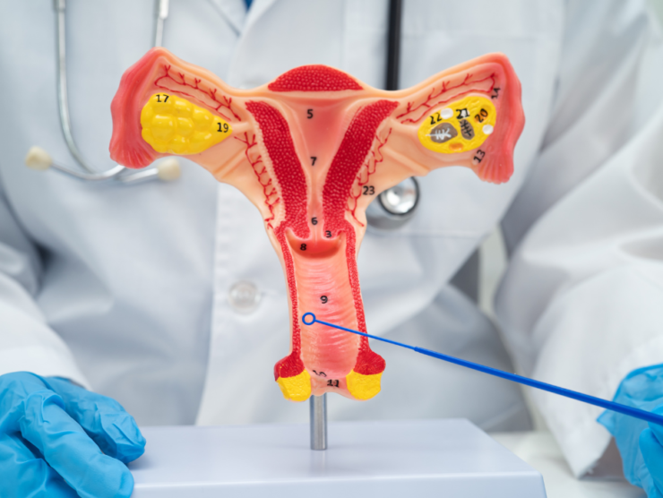 IVF TREATMENT FOR OBSTRUCTIVE AND NON-OBSTRUCTIVE AZOOSPERMIA