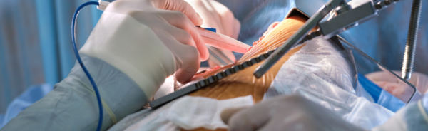 RECOVERY AFTER MICRO-TESE SURGERY: WHAT PATIENTS SHOULD EXPECT